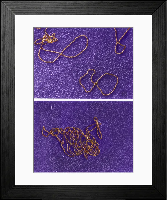 Framed Print : Circular DNA and Polymerase Reaction, TEM Framed Print : Circular DNA and Polymerase Reaction, TEM