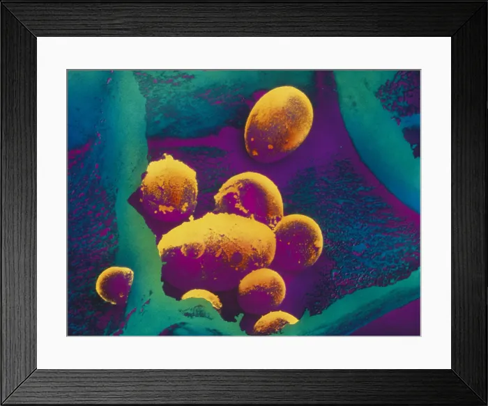 Framed Print : Potato Starch in Plastid SEM