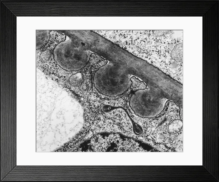 Framed Print : Tomato Chloroplast (TEM) Framed Print : Tomato Chloroplast (TEM)