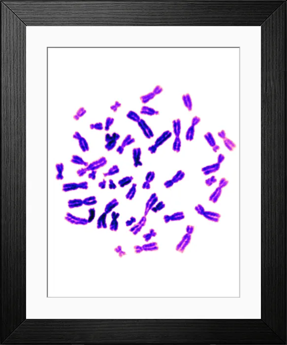 Framed Print : Karyotype, Normal Female Chromosomes Framed Print : Karyotype, Normal Female Chromosomes
