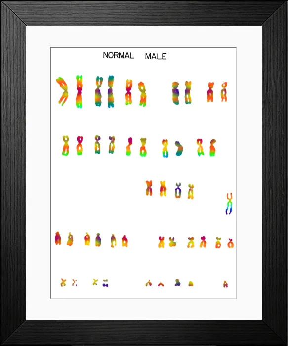 Framed Print : Karyotype, Normal Male Chromosomes Framed Print : Karyotype, Normal Male Chromosomes