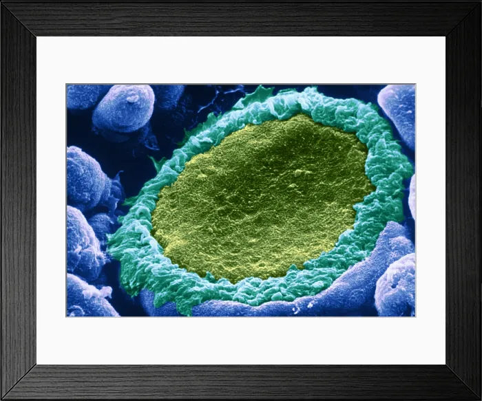 Framed Print : Taste bud. Color enhanced electron micrograph of taste buds; groups of Framed Print : Taste bud. Color enhanced electron micrograph of taste buds; groups of