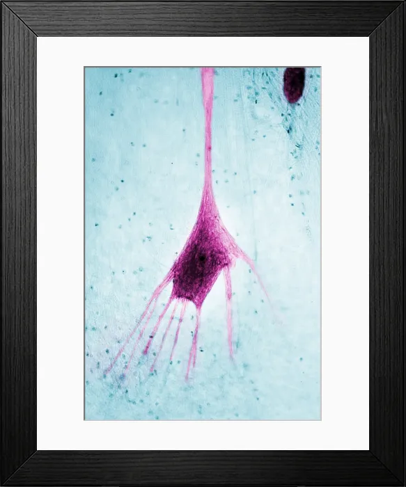 Framed Print : Nervous System, Human Neuron, light micrograph Framed Print : Nervous System, Human Neuron, light micrograph