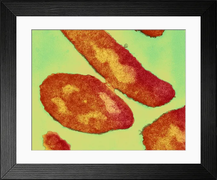 Framed Print : Bacteria, Genetic Recombination, TEM