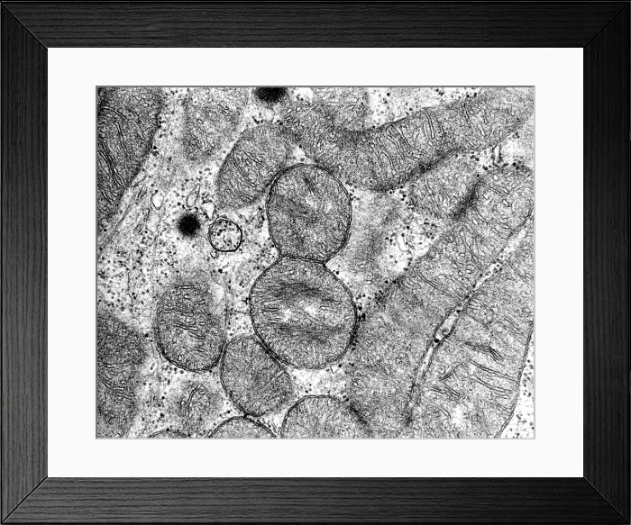 Framed Print : Dividing Mitochondrion, TEM Framed Print : Dividing Mitochondrion, TEM