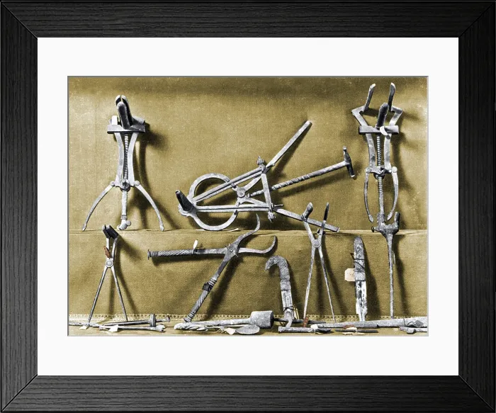 Framed Print : Roman Surgical Instruments, 1st Century Framed Print : Roman Surgical Instruments, 1st Century