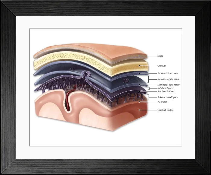 Framed Print : Layers of Meninges Framed Print : Layers of Meninges