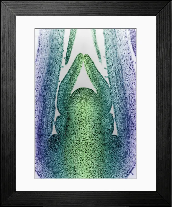 Framed Print : Honeysuckle Stem, light micrograph