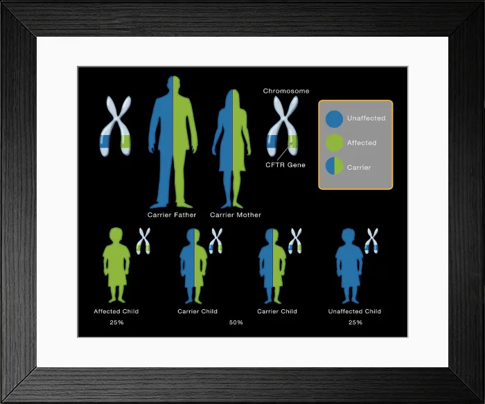 Framed Print : Cystic fibrosis disease CFTR genetic mutation Inheritance pattern diagram of parents and children Framed Print : Cystic fibrosis disease CFTR genetic mutation Inheritance pattern diagram of parents and children