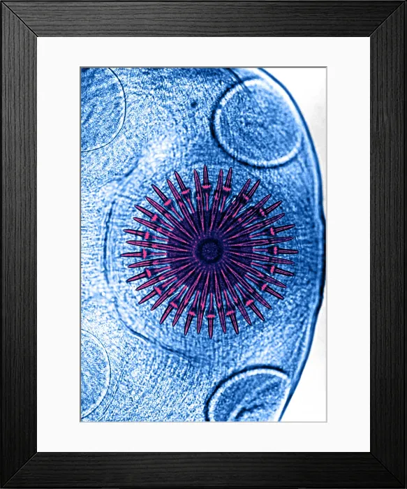 Framed Print : Dog Tapeworm Rostellum (LM) under a microscope Framed Print : Dog Tapeworm Rostellum (LM) under a microscope