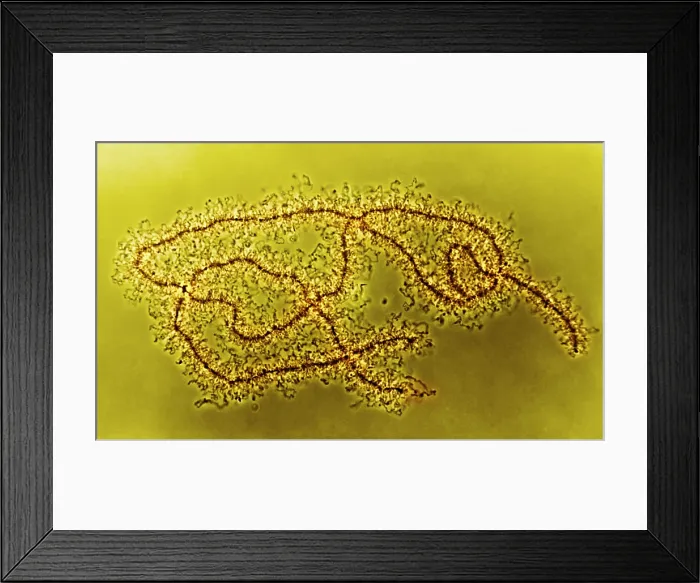 Framed Print : Genetics, Lampbrush Chromosomes, light micrograph Framed Print : Genetics, Lampbrush Chromosomes, light micrograph