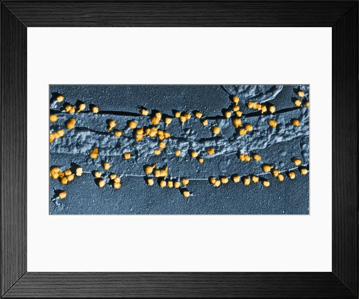 Framed Print : Bacteriophage T-2 Infecting E. coli Cell Wall, TEM Framed Print : Bacteriophage T-2 Infecting E. coli Cell Wall, TEM