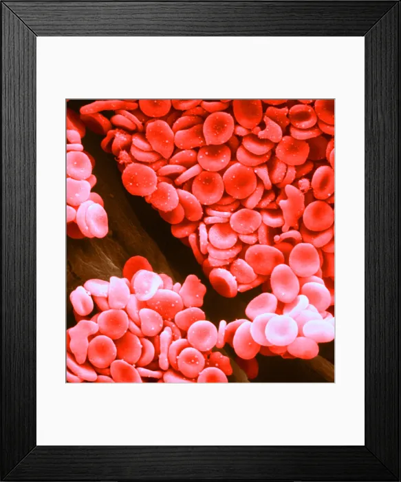 Framed Print : Circulatory System, Red Blood Cells, under a microscope (SEM)