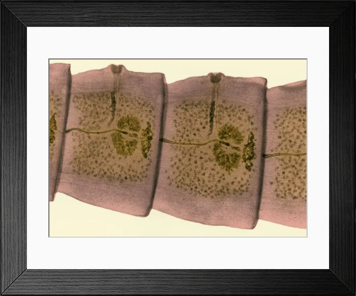 Framed Print : Tapeworm (Taenia sp.) under a microscope Framed Print : Tapeworm (Taenia sp.) under a microscope