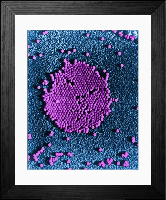 Framed Print : Human Enterovirus, Poliovirus, TEM Framed Print : Human Enterovirus, Poliovirus, TEM