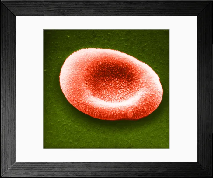 Framed Print : Red Blood Cell, under a microscope (SEM) Framed Print : Red Blood Cell, under a microscope (SEM)