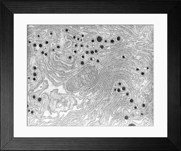 Framed Print : Pancreas, Endoplasmic Reticulum, TEM Framed Print : Pancreas, Endoplasmic Reticulum, TEM