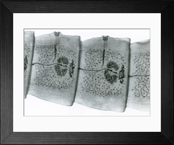Framed Print : Tapeworm (Taenia sp.) under a microscope Framed Print : Tapeworm (Taenia sp.) under a microscope