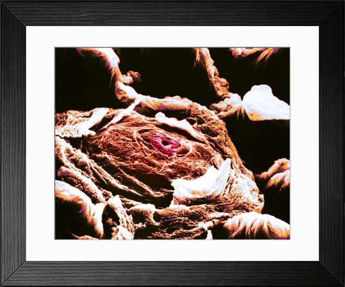 Framed Print : Human tongue papilla, under a microscope (SEM) Framed Print : Human tongue papilla, under a microscope (SEM)