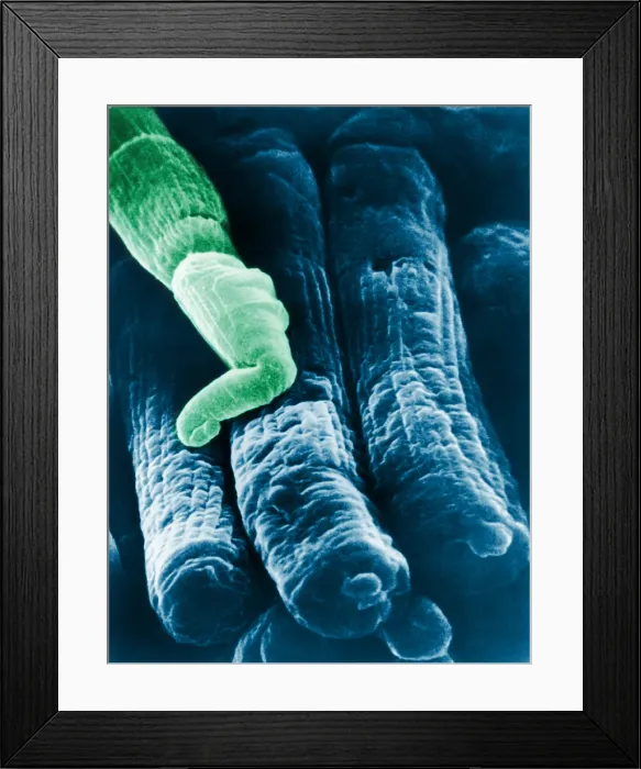 Framed Print : Rods and Cones