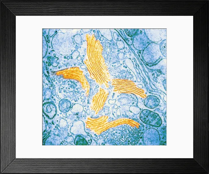 Framed Print : TEM of Golgi Bodies