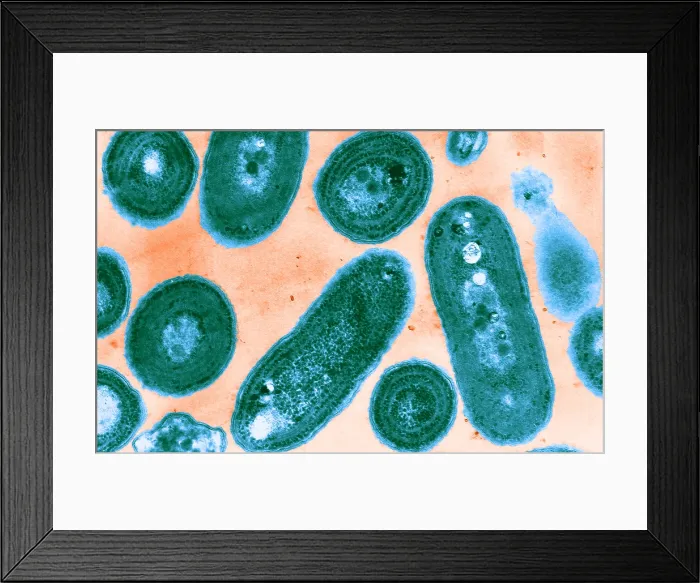 Framed Print : Blue-Green Algae, TEM Framed Print : Blue-Green Algae, TEM
