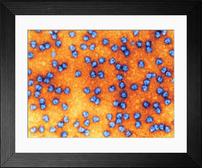 Framed Print : Cell Structure, Ribosomes, TEM Framed Print : Cell Structure, Ribosomes, TEM