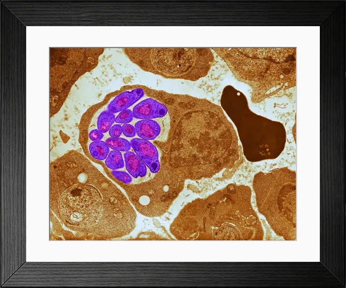 Framed Print : Malaria, Plasmodium cathemerium, TEM Framed Print : Malaria, Plasmodium cathemerium, TEM