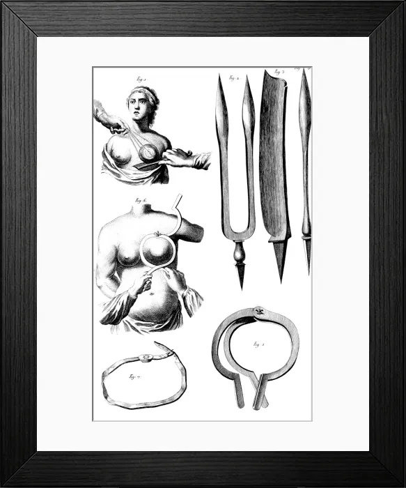 Framed Print : Breast Surgery Instruments, 1772 Framed Print : Breast Surgery Instruments, 1772