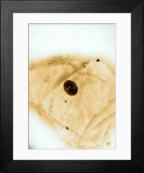 Framed Print : Genetics, Barr Body, light micrograph Framed Print : Genetics, Barr Body, light micrograph