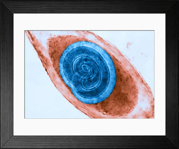 Framed Print : Trichinella in Muscle (LM) under a microscope