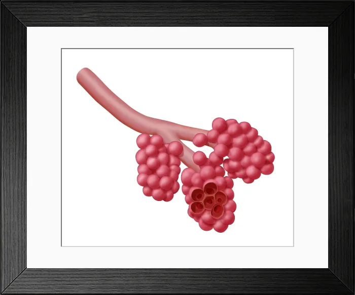Framed Print : Alveoli. Illustration of alveoli, the small air sacs at the end of the respiratory tree 
