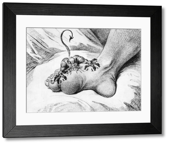 Framed Print : The Pain of Gout, 1799