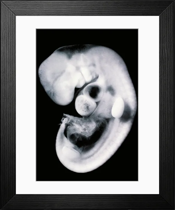 Framed Print : Human embryo Framed Print : Human embryo