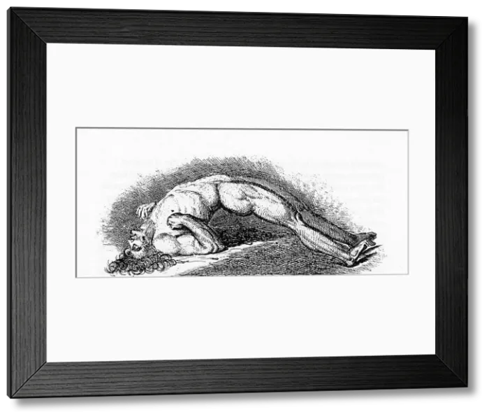 Framed Print : Opisthotonos