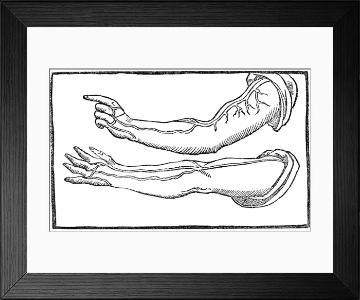 Framed Print : Jacopo Berengario da Carpi, Arteries Framed Print : Jacopo Berengario da Carpi, Arteries