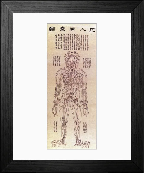 Framed Print : Chinese Acupuncture Chart, 1906