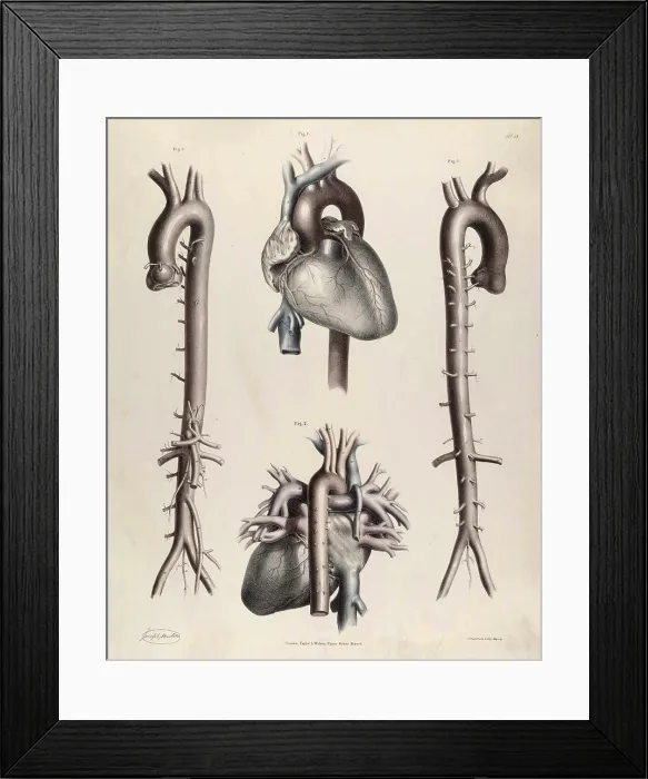 Framed Print : Historical Anatomical Illustration