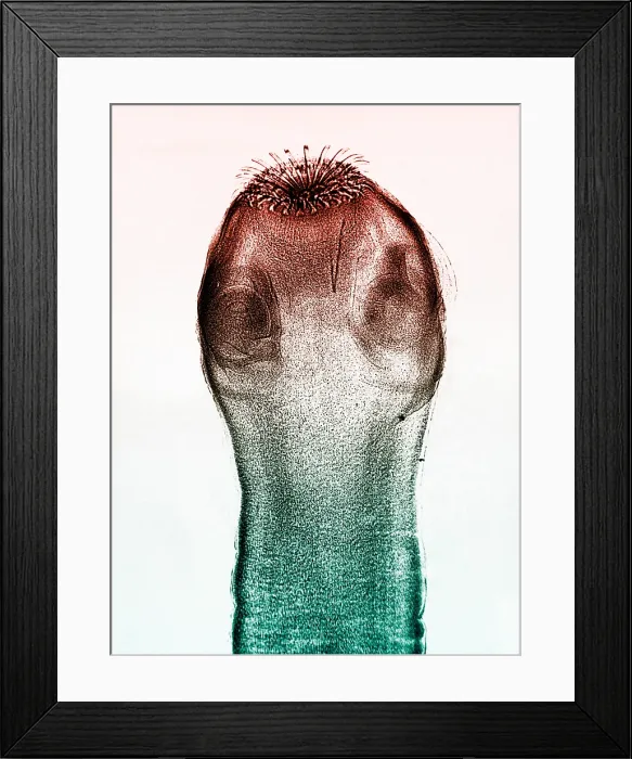 Framed Print : Dog Tapeworm Scolex, light micrograph Framed Print : Dog Tapeworm Scolex, light micrograph