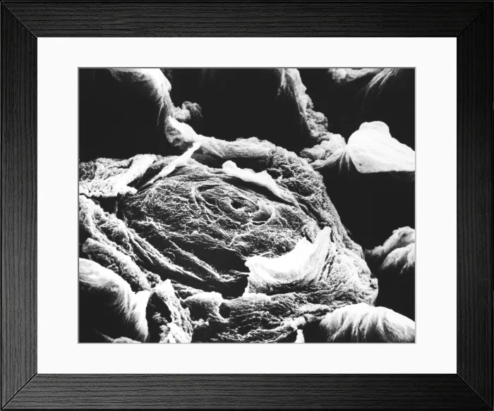 Framed Print : Human tongue papilla, under a microscope (SEM) Framed Print : Human tongue papilla, under a microscope (SEM)