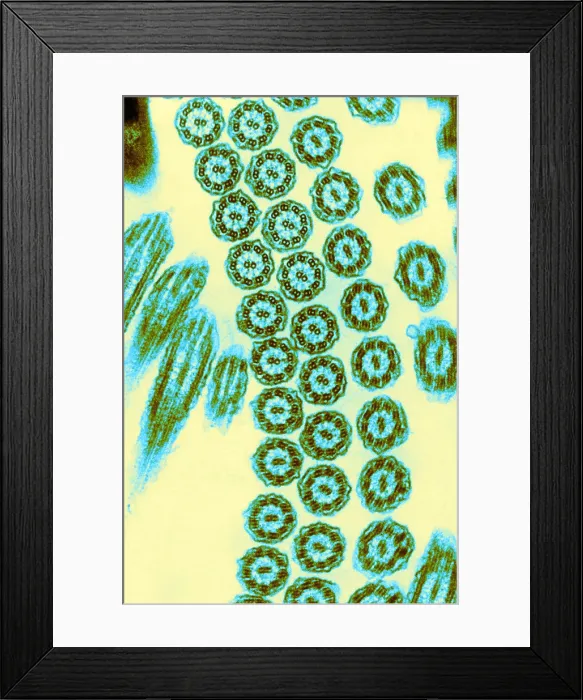 Framed Print : Cilia from Ciliates (TEM) Framed Print : Cilia from Ciliates (TEM)
