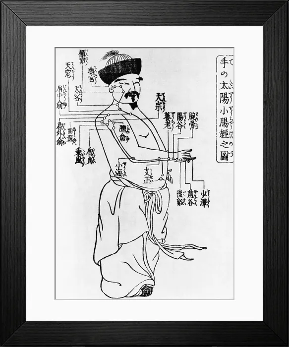 Framed Print : Acupuncture Points, 1805 Framed Print : Acupuncture Points, 1805