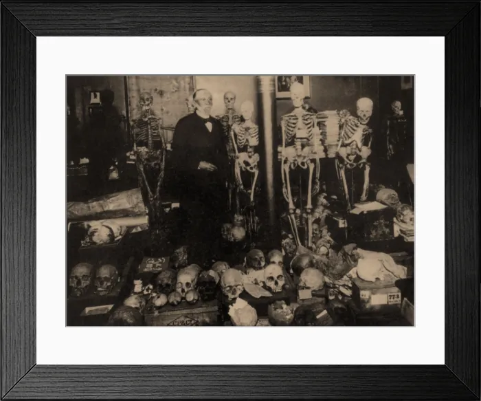 Framed Print : Rudolph Virchow, German Pathologist Framed Print : Rudolph Virchow, German Pathologist