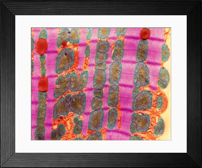Framed Print : Cardiac Muscle, TEM Framed Print : Cardiac Muscle, TEM