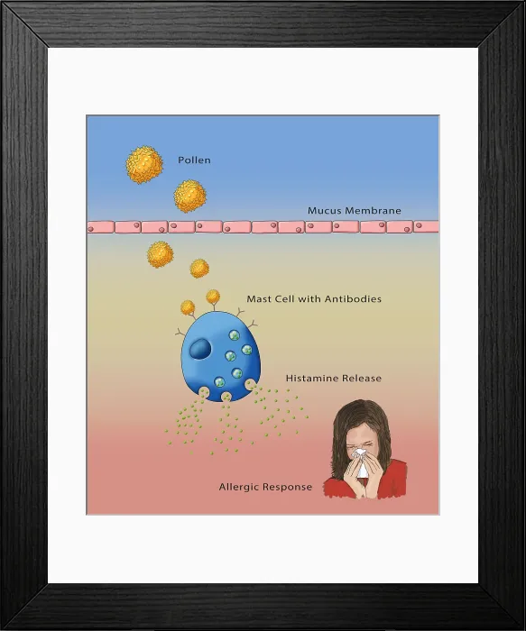 Framed Print : Allergic Response, Illustration Framed Print : Allergic Response, Illustration