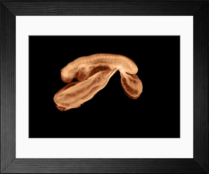 Framed Print : 23 day old human embryo