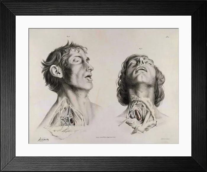 Framed Print : Historical Anatomical Illustration