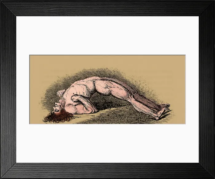 Framed Print : Opisthotonos