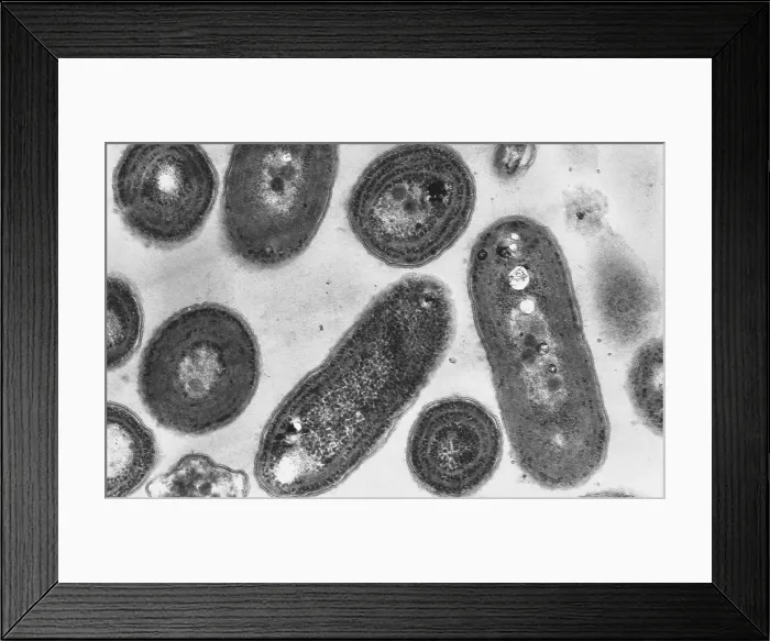 Framed Print : Blue-Green Algae, TEM Framed Print : Blue-Green Algae, TEM