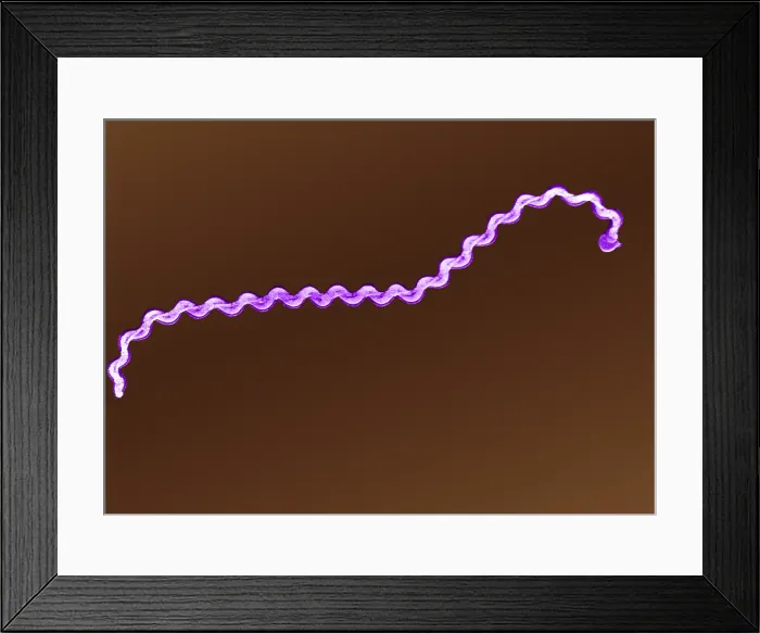 Framed Print : Leptospira Bacteria, under a microscope (SEM) Framed Print : Leptospira Bacteria, under a microscope (SEM)